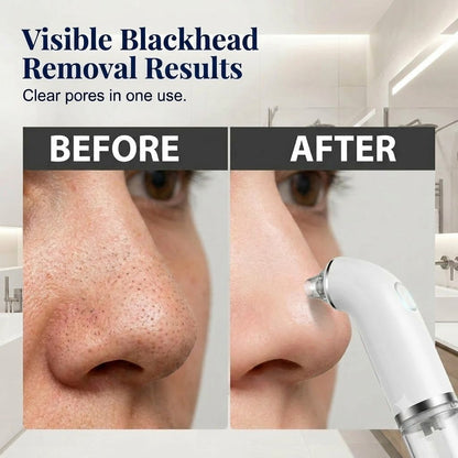 Electric facial cleanser · Lifting and firming · Deep pore cleansing