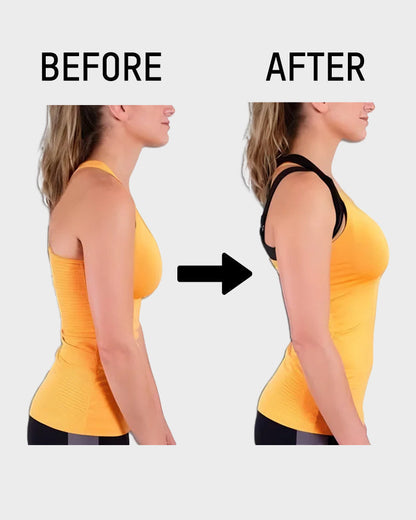 Hot Sale 70% OFF - Cross Back Front Closure Wireless Posture Support Bra